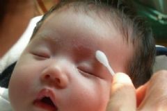 被蚊蟲叮咬紅腫怎么辦？蚊蟲叮咬紅腫用什么藥？[圖]