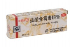 鹽酸金霉素軟膏可以祛痘嗎？鹽酸金霉素軟膏的作用[圖]