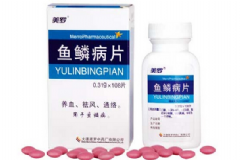 魚鱗病片效果如何？魚鱗病的治療及保養(yǎng)[圖]