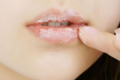 冬季嘴唇起皮的原因有哪些？唇部該如何護(hù)理才好？[多圖]