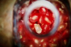 石榴籽泡酒的功效與作用？石榴籽怎么泡酒？[圖]