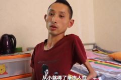 漸凍人身高1.75米體重25公斤，愛心媽媽助他挑戰(zhàn)泰山[多圖]