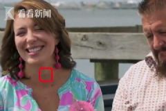 醫(yī)生看電視發(fā)現(xiàn)“腫瘤”，用“鷹眼”挽救了一個(gè)人的生命[多圖]