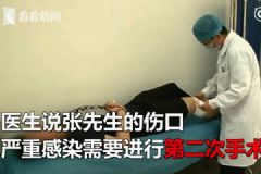 手術(shù)后天天喝骨頭湯傷口竟感染，膝蓋手術(shù)后飲食注意事項(xiàng)[多圖]