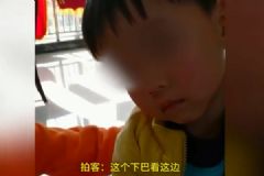 躺著玩手機太久，男童變歪頭寶寶！[多圖]