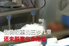熊孩子玩打火機(jī)引發(fā)大火！燒傷家人自己命在旦夕！[多圖]