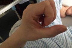 一天打兩場(chǎng)麻將患腱鞘炎，你還敢久坐嗎？什么是手指腱鞘炎？[多圖]