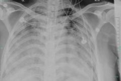 孕婦患重癥流感送進(jìn)ICU，孕期感冒要注意什么？[多圖]