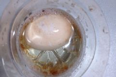 喝白醋泡雞蛋的副作用有哪些？醋泡雞蛋一次喝多少？[圖]