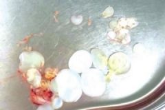 男子吃生肉活蟲入腦，吃生肉的危害有哪些？[多圖]