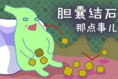 哪些人最容易得膽結(jié)石？膽結(jié)石有哪些明顯特征？[多圖]