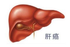 30歲不喝酒不抽煙卻患肝癌！到底是什么原因引發(fā)肝癌？[多圖]