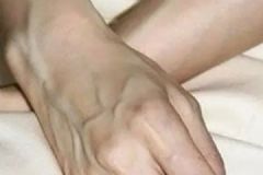 手上長這個一定要小心！皮膚青筋凸起怎么辦？[多圖]