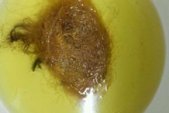 玉米須喝多久能消水腫？用玉米須消水腫的做法[多圖]