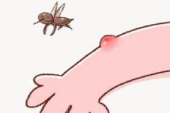 防蚊子叮咬的妙方有哪些？蚊子叮咬了怎么辦？[多圖]