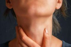 甲狀腺癌有何癥狀？甲狀腺癌怎么治療？[多圖]