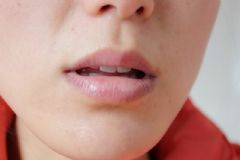 冬天嘴唇發(fā)紫怎么辦？冬天嘴唇發(fā)紫是什么原因？[多圖]