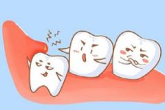 長(zhǎng)了智齒應(yīng)該怎么辦？智齒到底拔還是不拔？[多圖]