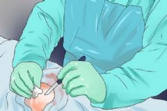 胃酸過多想吐怎么緩解？如何才能緩解胃酸帶來的痛苦呢？[圖]