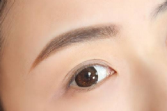 眉毛稀疏該怎么辦？導(dǎo)致眉毛稀疏的原因是什么？[圖]