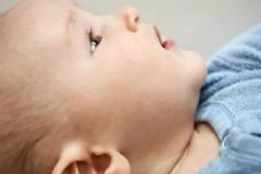 孩子患中耳炎的危害有哪些？兒童中耳炎如何診斷？[圖]