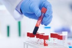 中性粒細(xì)胞百分比偏低怎么回事？中性粒細(xì)胞絕對值偏低咋辦？[多圖]