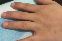 冬天總是凍手凍腳怎么辦？冬天凍手凍腳如何預(yù)防？[多圖]