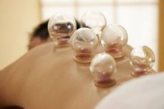 拔火罐對(duì)人有何好處？拔火罐不適合什么人？[圖]