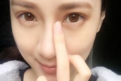 流鼻血舉手有用嗎？流鼻血時該如何處理？[圖]