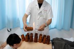 拔罐對(duì)肝臟有好處嗎？肝經(jīng)拔罐位置是哪里？[圖]