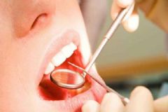 口腔黏膜白斑如何治？口腔黏膜有何癥狀？[圖]