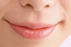 口角炎是口腔潰瘍嗎？怎么區(qū)分口腔潰瘍和口角炎？[圖]