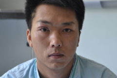 上瞼下垂的癥狀有哪些？上瞼下垂的病因有哪些？[圖]