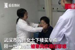 女子出門買早點被風(fēng)吹成面癱，面癱該怎么預(yù)防？[多圖]