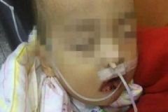 一歲半男童誤把火堿當(dāng)白糖吃下致生命垂危，吃了火堿會(huì)怎樣？[多圖]