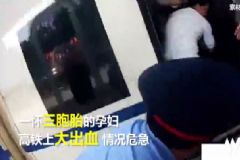 三胞胎孕婦火車上大出血，孕婦大出血該怎么辦？[多圖]