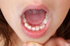 口腔保健的誤區(qū)有哪些？口腔保健要注意些什么？[圖]