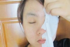 面膜敷在臉上辣辣的是怎么回事？為什么敷面膜之后感覺辣辣的？[圖]