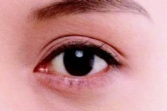 水乳可以擦眼睛周圍嗎？眼睛周圍用這些護(hù)膚品更好？[圖]