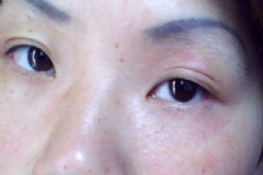 如何快速擺脫肌膚過(guò)敏？肌膚過(guò)敏怎么調(diào)理？[圖]