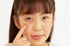 凍臉后很癢這么辦？臉凍傷了很癢怎么辦？[圖]