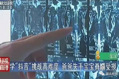 學(xué)“抖音”翻跟頭，爸爸失手2歲寶寶脊髓嚴(yán)重受損[多圖]