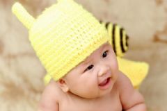 嬰幼兒被燙傷怎么應(yīng)對？寶寶的皮膚容易有哪些問題？[多圖]
