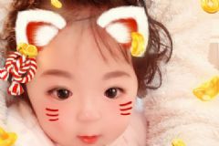 嬰幼兒缺鋅會(huì)有哪些癥狀表現(xiàn)？怎樣給嬰幼兒補(bǔ)鋅比較好？[多圖]