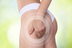 抽脂減肥有哪些誤區(qū)？抽脂減肥要如何護(hù)理？[圖]