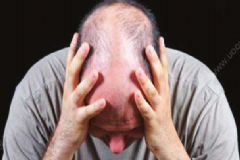 男性脫發(fā)是什么原因造成的？男人脫發(fā)是哪些原因?qū)е碌?？[圖]