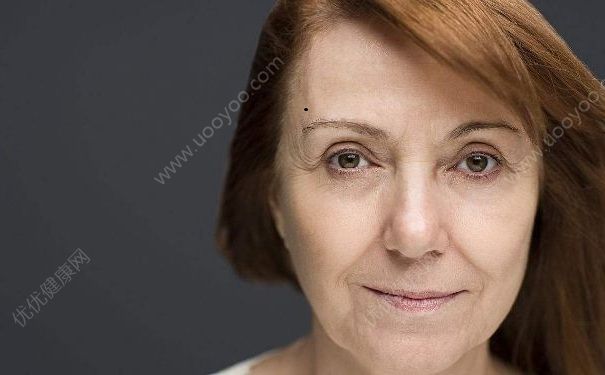 女性除皺有哪些方式？女性除皺要注意什么？(1)