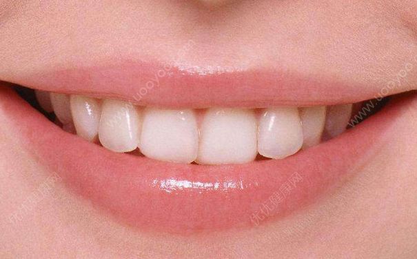 牙齒整形一般多少錢(qián)？牙齒整形要注意什么？(1)