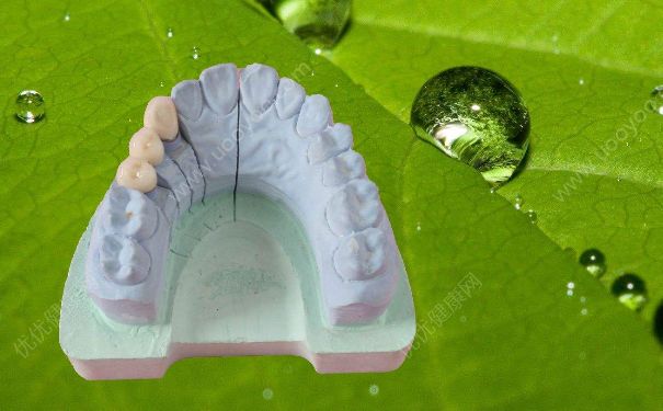 烤瓷牙能用多長(zhǎng)時(shí)間？怎么護(hù)理好烤瓷牙？(1)