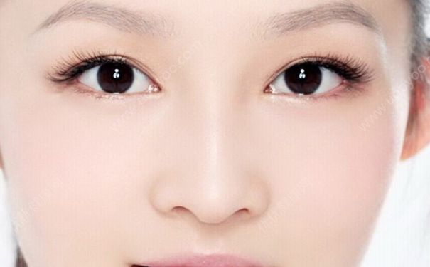 內(nèi)吸去眼袋好不好？內(nèi)吸去眼袋術(shù)后有什么注意事項(xiàng)？(1)